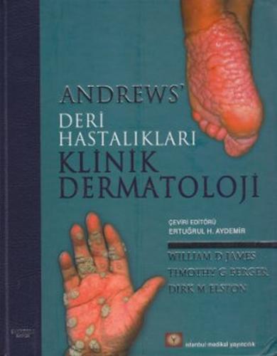 Andrew's Deri Hastalıkları Klinik Dermatoloji