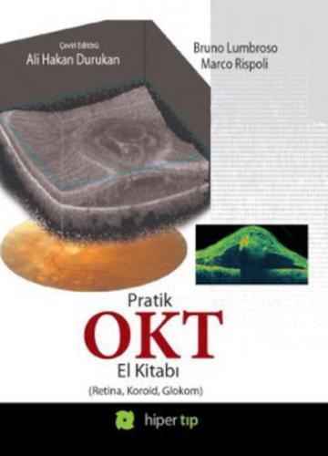 Pratik OKT El Kitabı (Retina, Koroid, Glokom)