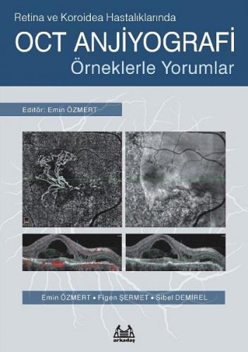 Retina ve Koroidea Hastalıklarında OCT Anjiyografi - Örneklerle Yoruml